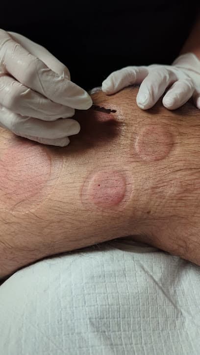 Photo of Hijama Glory
