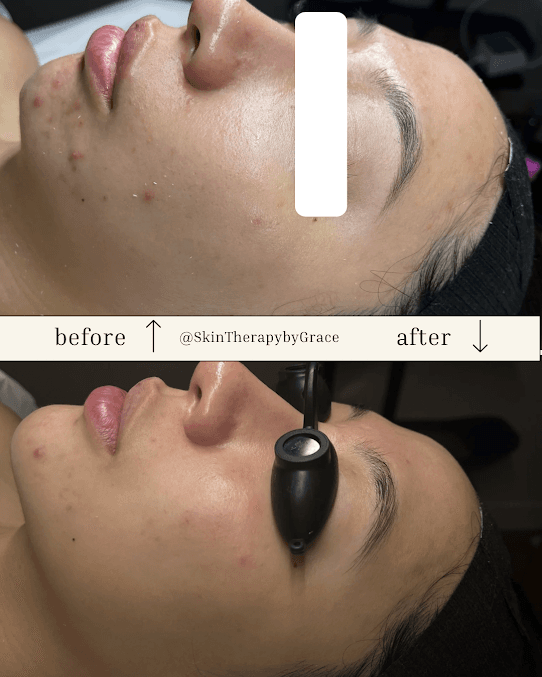 Photo of Skin Therapy by Grace