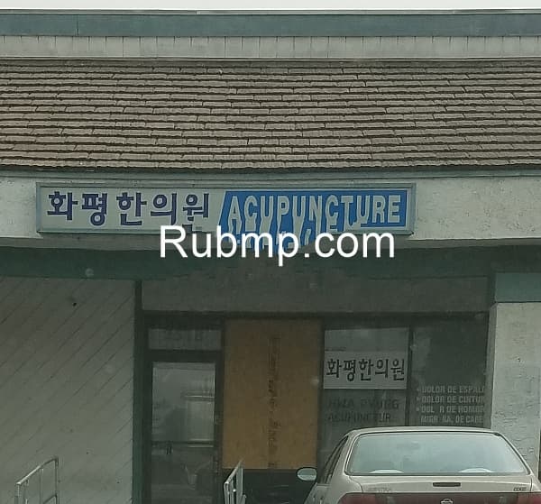 Photo of Acupuncture