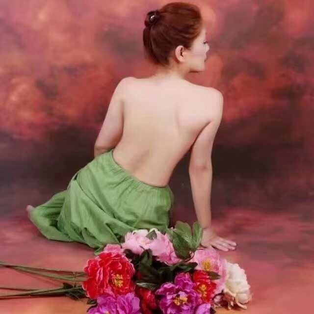 Cupping photo