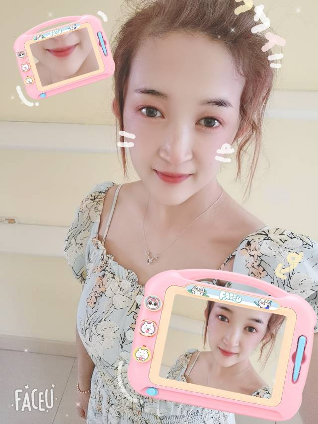 I think photo